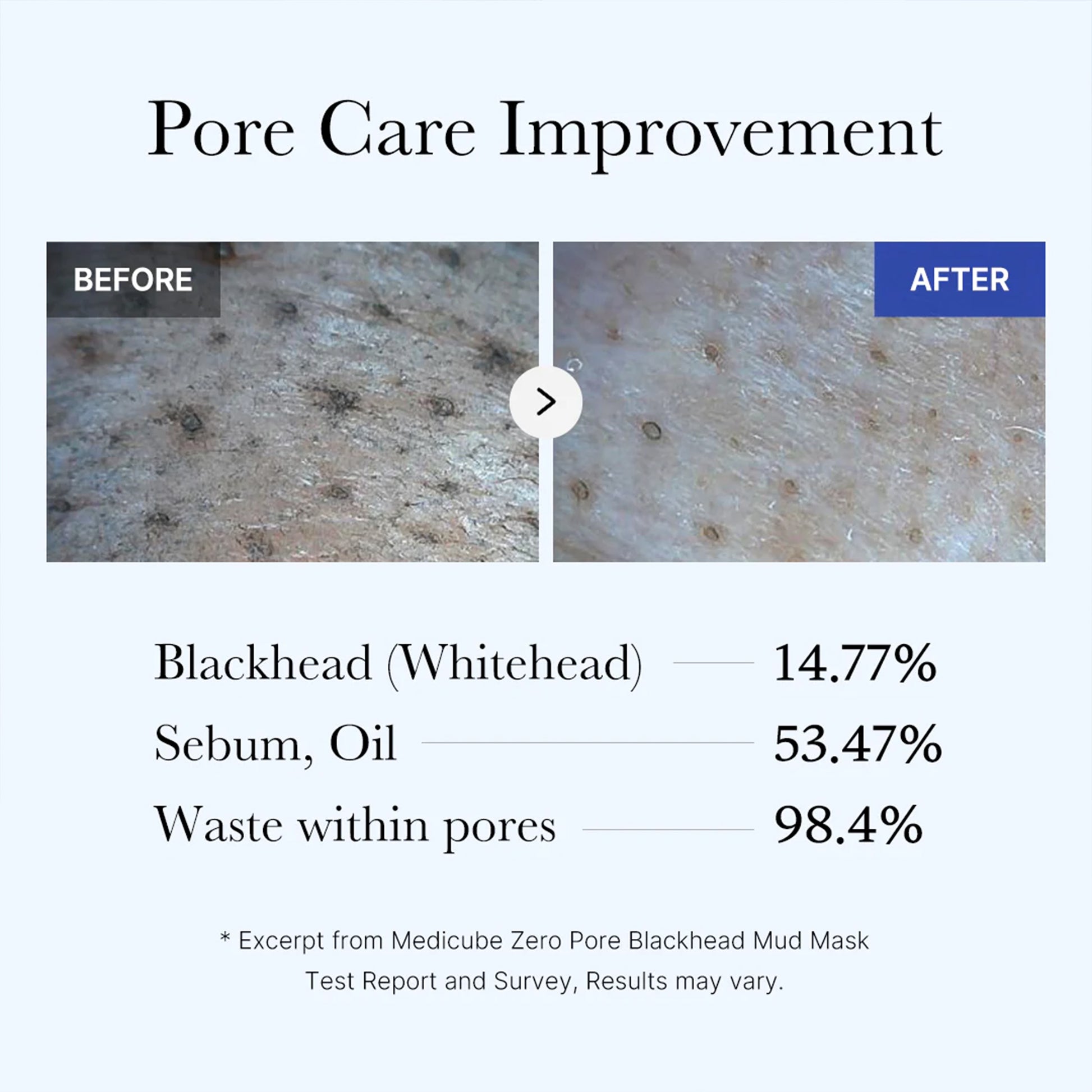 Zero Pore Blackhead Mud Mask - medicube.us