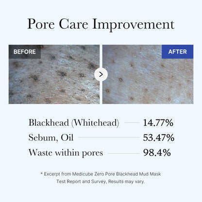 [Subscr.] Zero Pore Blackhead Mud Mask - medicube.us