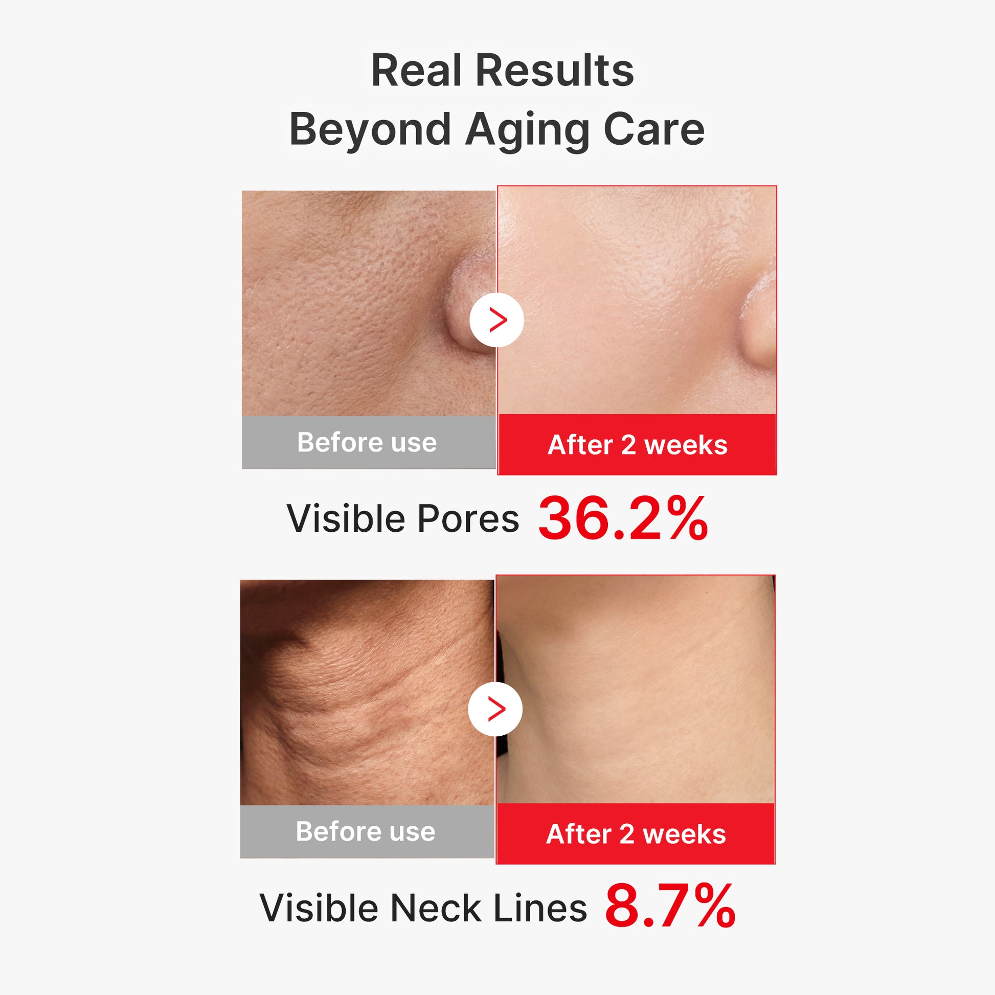 EGF NAD+ Firming Serum - medicube.us